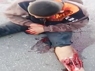 2  man victim of shocking accident 