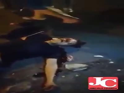 man hit by car and have leg cut