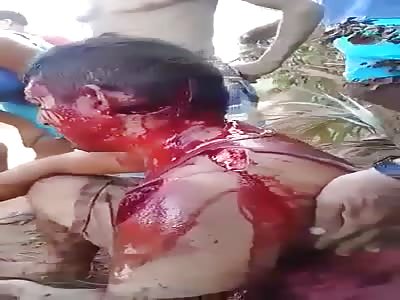 Man injured in machete attack.