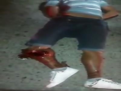 Terrible injury, very bad people, very bad.