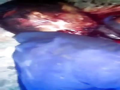 murdered homeless person. Com cut neck