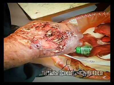 Hand full of tasty white maggots - La Tía Del Gore 