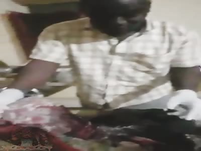 Woman with multiple knife wounds