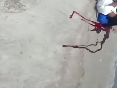 Agony, his last breaths of life