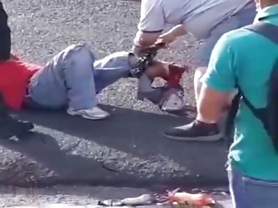 Man with shattered leg after being run over