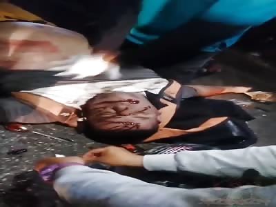 CPR after crashing into a car on his motorcycle