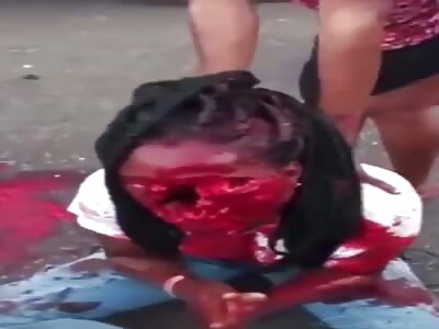 Not Doing Too Good Following Accident