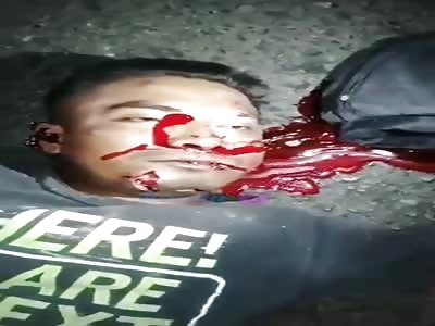 Cyclist was run over