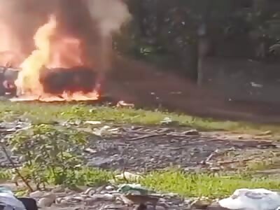 man burned in his car