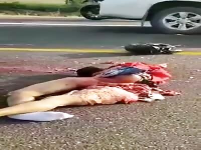 Young Dude Fucked Up/Mangled In Accident