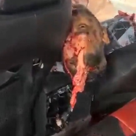 Dude Got Fucked Up In Crash