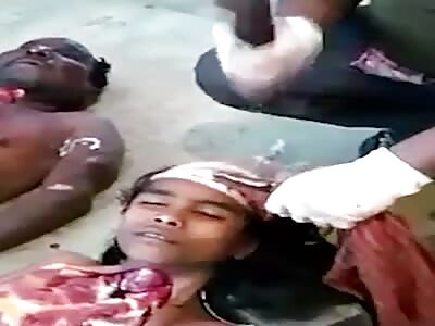 Cracking Open Her Skull