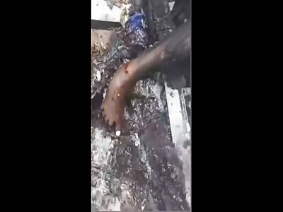 Young Woman Burnt To A Crisp