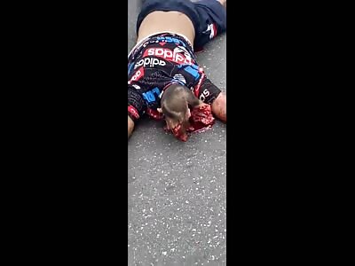 Biker's Head Split The Fuck Open In Crash