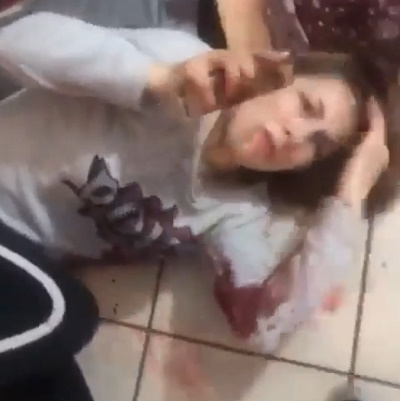 Dude Stabbed His Teenage Daughter