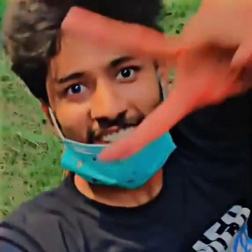 Dumbass Smiling For The Camera With His Fucked Up Hand