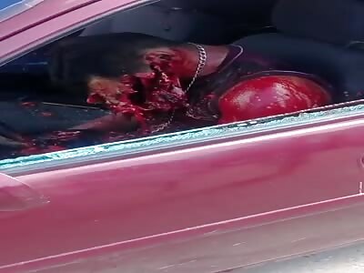 Dude's Face Fucked Up From Execution (Short)