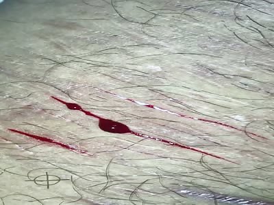 Fat faggot cutting himself