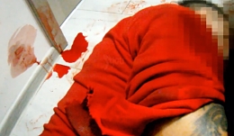 Czech cops rescue a cut man