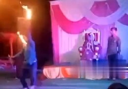 Here's one for fire breather accident!