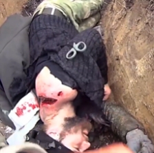 RU soldier receiving firs aid after UA artillery strike