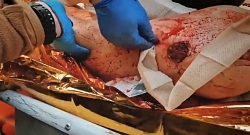 Ukrainian medic provides first aid to wounded soldier