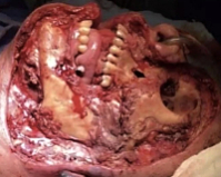 Death, Illness, Injury, Healing #2 (compilation)