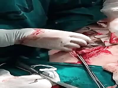 Eliminating the consequences of trichotillomania...