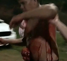 Man with his guts exposed after being stabbed