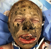 Death, Illness, Injury, Healing #4 (compilation)