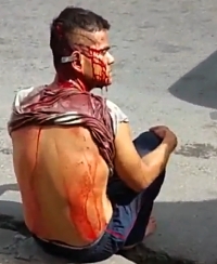 The man has a knife stuck in his ear