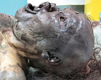 Death, Illness, Injury, Healing #5 (compilation)