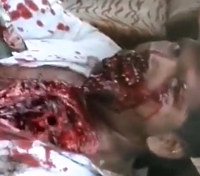 A horrible accident tore his entrails