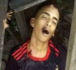 An 18-year-old youth was shot