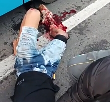 A young man's almost amputated leg