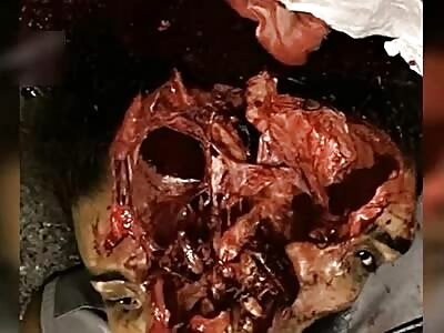 Death, Illness, Injury, Healing #10 (compilation)