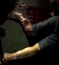 The motorcyclist suffered brutal injuries after the accident