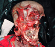 Death, Illness, Injury, Healing #11 (compilation)