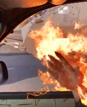 Beautiful Girl Burned In Ukraine