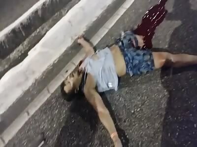 Victim has his leg amputated when a motorcycle collides