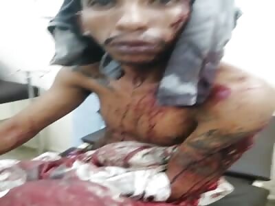 inmate with wounds on his body