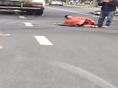 The woman had her leg severed in an accident.