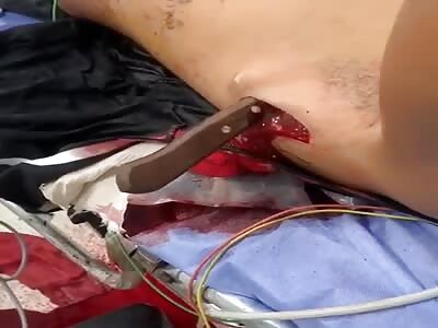 Victim of street fight.