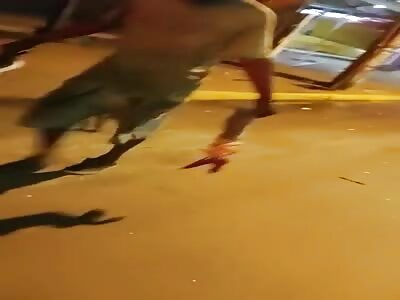 Biker loses his leg after hitting a pole