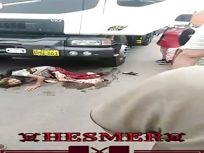 Poor lady got her legs crushed by truck
