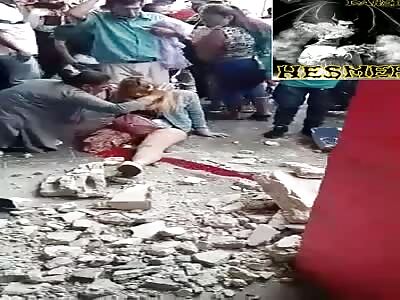 Beautiful girl has leg severed in accident.