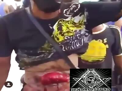 Man with exposed guts 