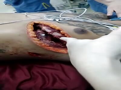 Man with an extreme cut on his chest.