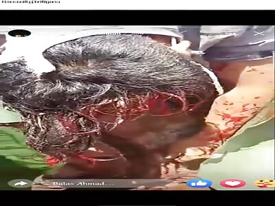 Vietnamese man dies in fatal accident