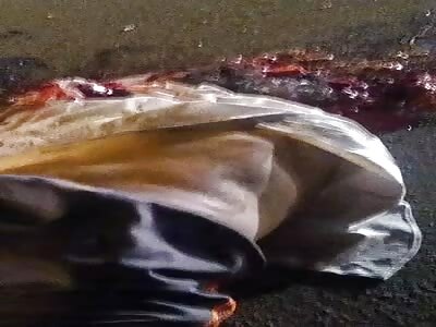 Cyclist has his head crushed in colatina, Brazil